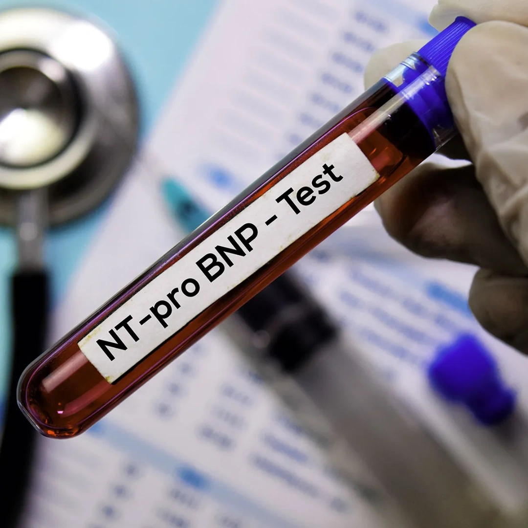 N-Terminal Pro B Natriuretic Peptide