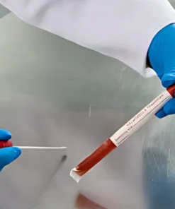 EPSTEIN BARR VIRUS (VCA) IGM ANTIBODIES