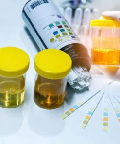 Opiates / Morphine-Urine- Random