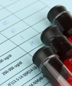 EPSTEIN BARR VIRUS EARLY ANTIGEN IGG ANTIBODIES