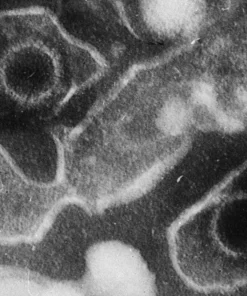 EPSTEIN BARR VIRUS IGG ANTIBODY