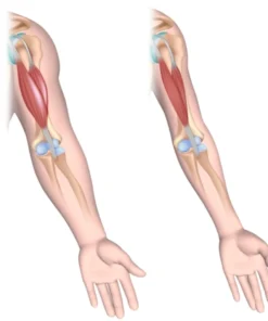 DUCHENNE MUSCULAR DYSTROPHY (DMD)-PCR