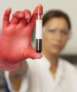 HCV VIRAL LOAD (QUANTITATIVE) ASSAY