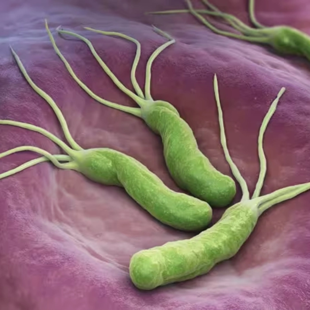 HELICOBACTER PYLORI IGG ANTIBODIES