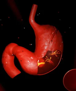 HELICOBACTER PYLORI ANTIBODY IGM, SERUM