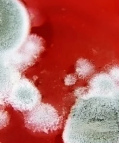 HEMATOCRIT, WHOLE BLOOD