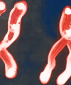 HEMATOLOGIC DISORDER KARYOTYPING (CML, AML, APML, ALL)