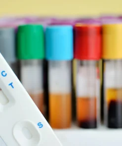 HEPATITIS C ANTIBODIES (CARD TEST)