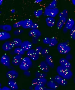 HER2/NEU ONCOGENE AMPLIFI- CATION FFPE SLIDE (FISH)