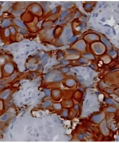 HER2NEU & ER/PR IHC PANEL*