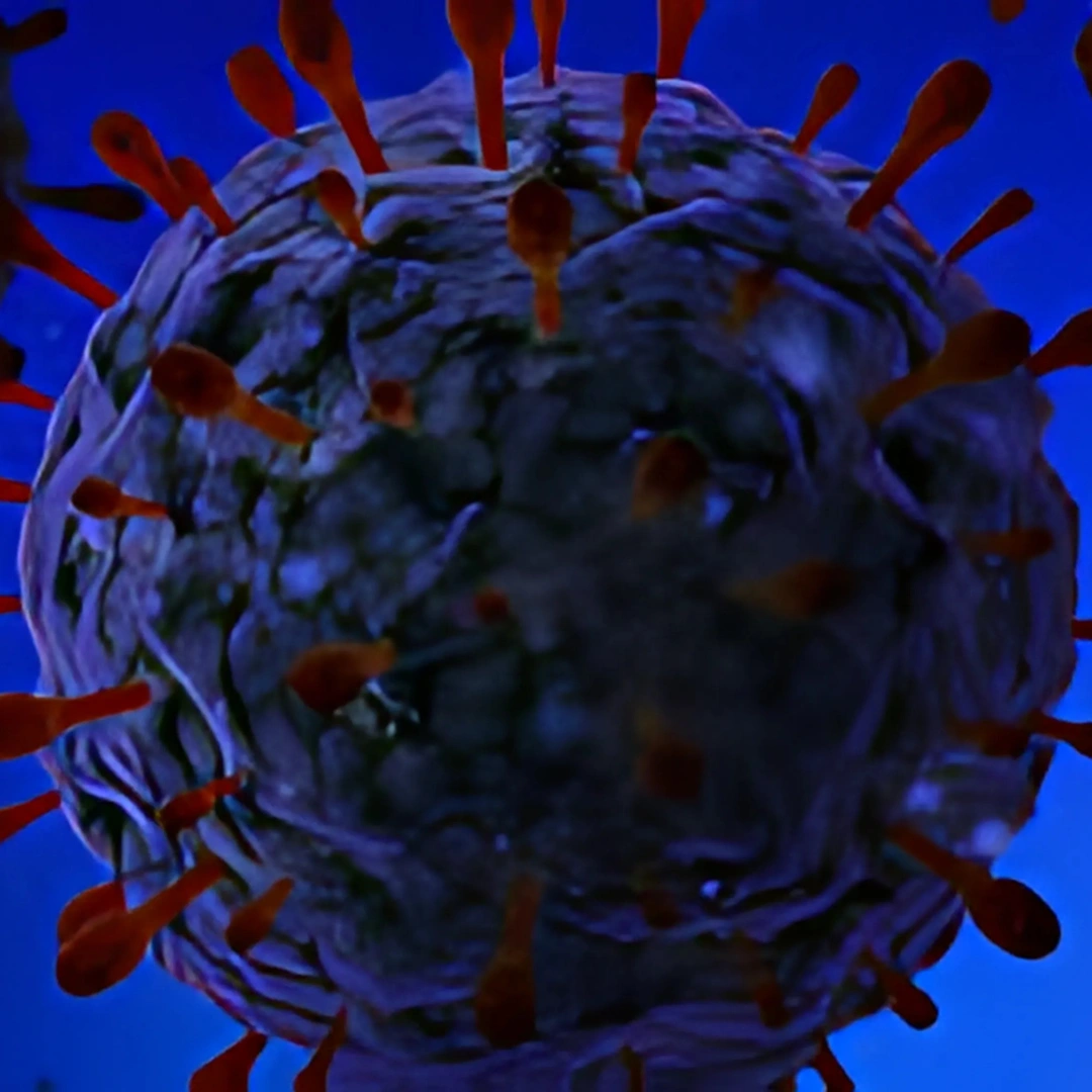 HERPES SIMPLEX VIRUS 1 IGM, SERUM