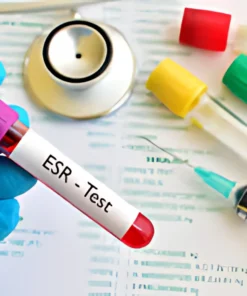 ERYTHROCYTE SEDIMENTA- TION RATE, WHOLE BLOOD