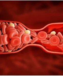 FACTOR - V (LEIDEN MUTATION)