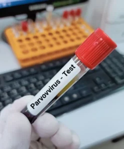 Parvovirus B19 Igm