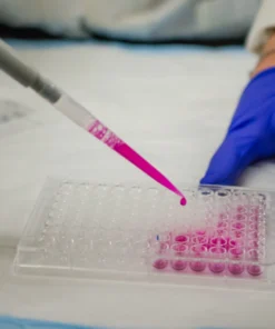 Periodic Acid Schiff (Pas) Stain