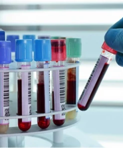 Peripheral Blood (Indivi- Dual Karyotyping )