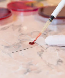 Peripheral Blood Smear Examination, Whole Blood