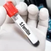 FERRITIN, SERUM