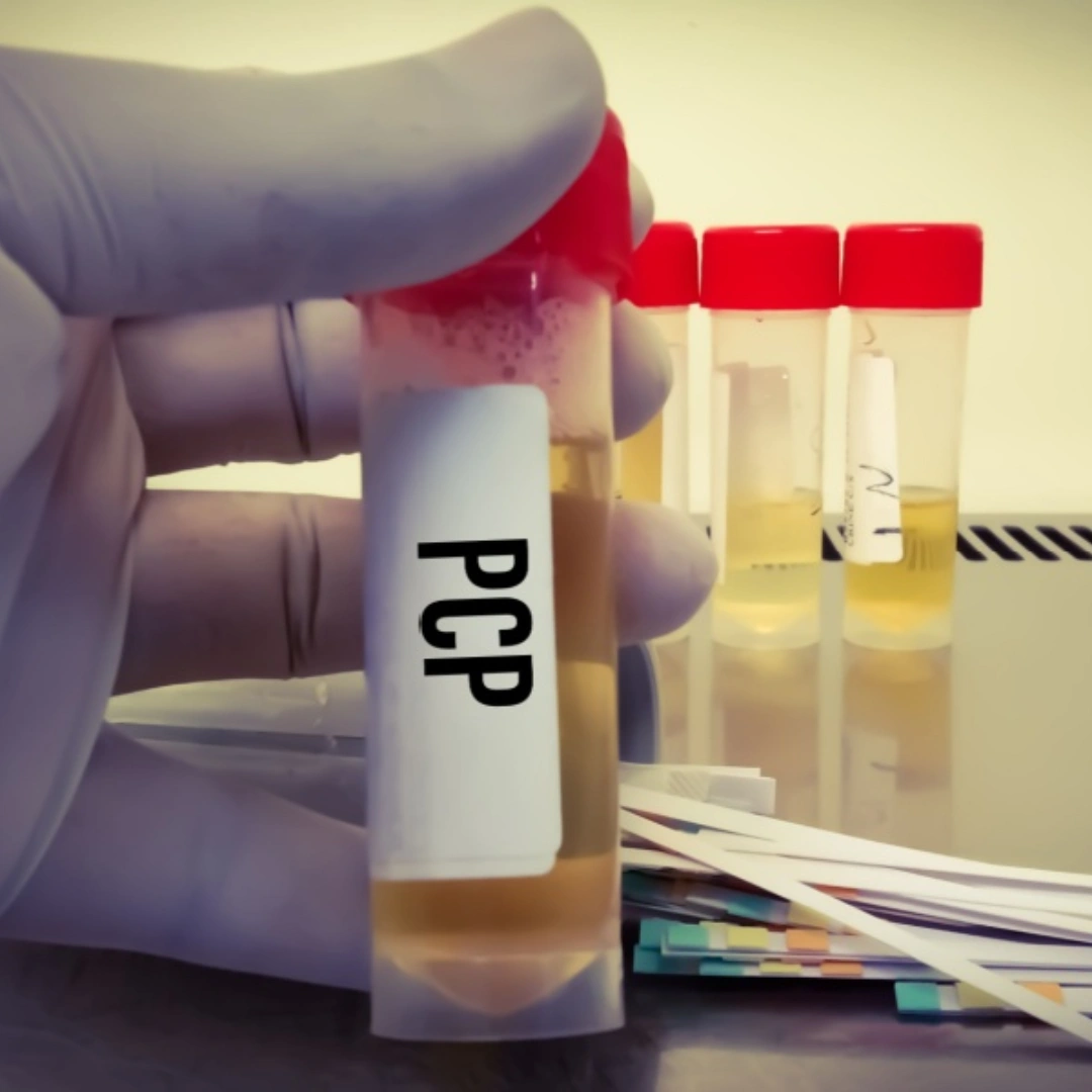 Phencyclidine (Pcp), Urine