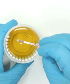 Phencyclidine (Pcp), Urine (Quantitative)