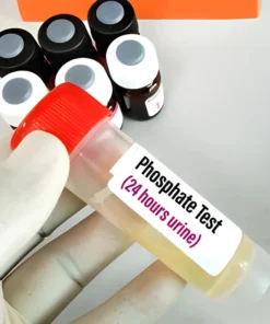 Phosphorus Inorganic, 24Hrs Urine