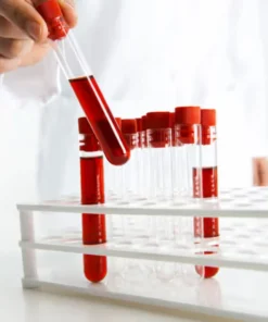 Phosphorus Inorganic, Serum