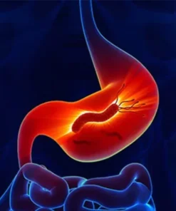 Platelet Antibodies, Indirect (Igg)