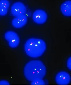 FISH FORÂ  PML-RARA