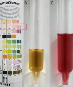 Porphobilinogen Urine