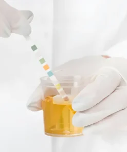 Porphyrins, 24Hrs Urine For Ib