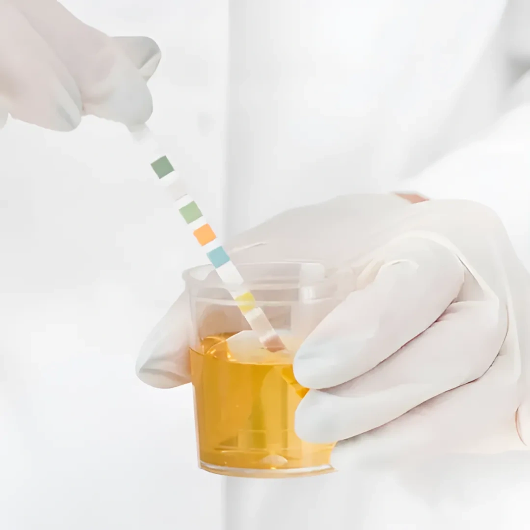 Porphyrins, 24Hrs Urine For Ib