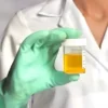 Potassium, 24 Hrs Urine