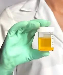Potassium, 24 Hrs Urine