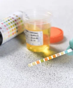 Potassium, Random Urine