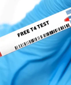 FREE THYROXINE(FT4), SERUM