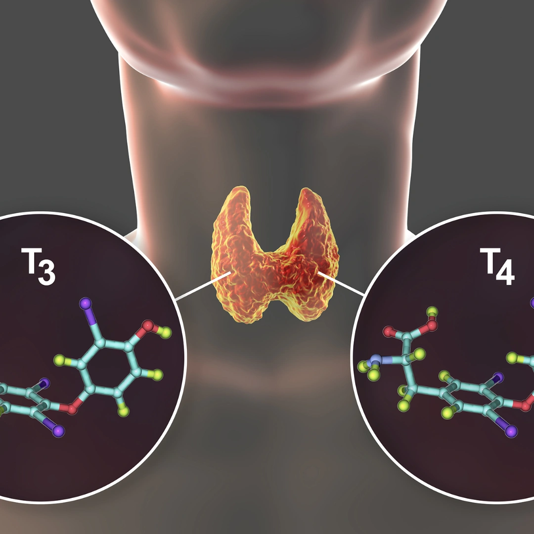 FREE TRI-IODOTHYRONINE (FT3), SERUM