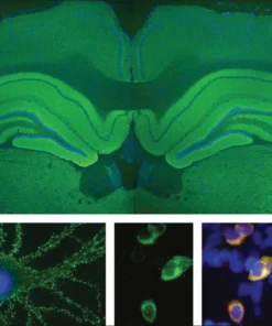 Nmda Receptor Antibody