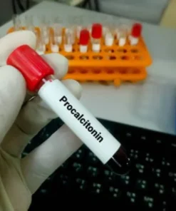 Procalcitonin , Serum