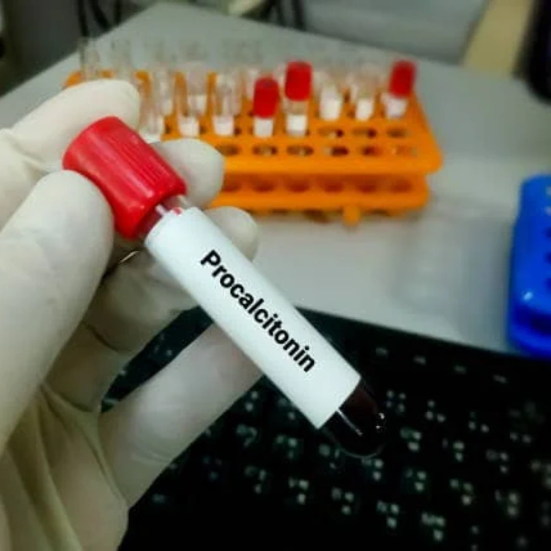 Procalcitonin , Serum