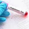 Progesterone, Serum
