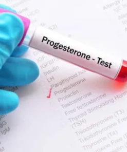 Progesterone, Serum