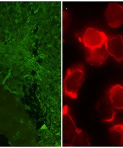 Nmo (Aquaporin 4)-Igg Serum