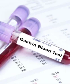 GASTRIN SERUM
