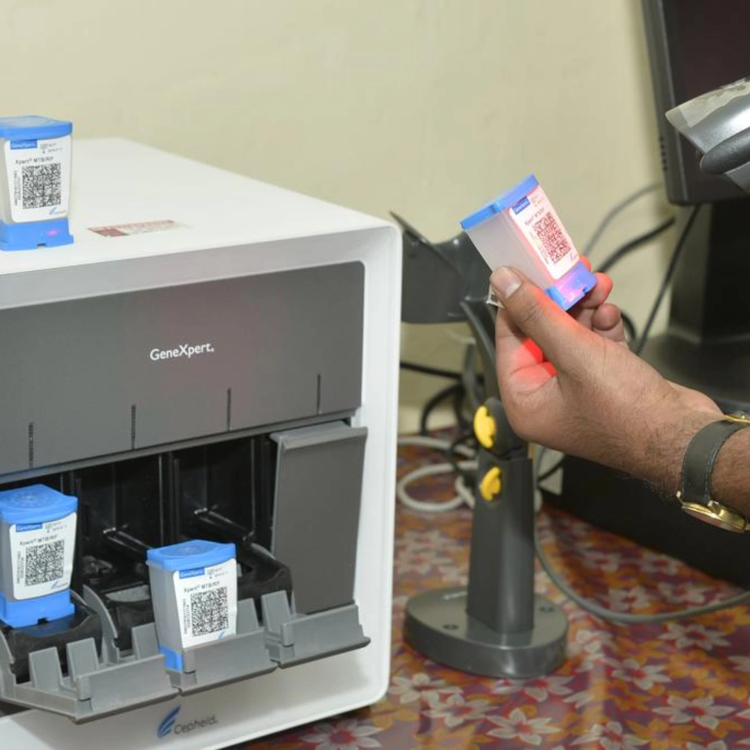 GENEXPERT MTB/RIF (CBNAAT)
