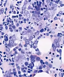 GIEMSA STAINING, TISSUE