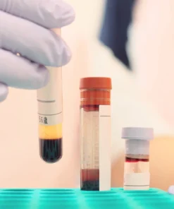 Protein Electrophoresis, Serum