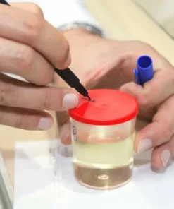 Protein Electrophoresis, Urine