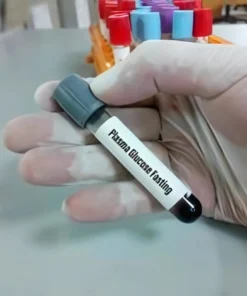 GLUCOSE ( 2 HRS AFTER 75 G GLUCOSE), PLASMA