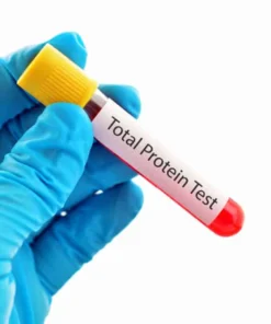 Protein Total, Serum