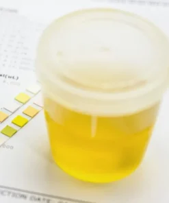 Protein, 24 Hrs Urine